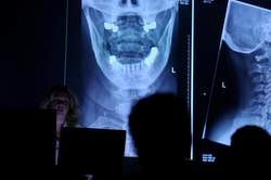 Frau steht vor Projektionswand mit Röntgenaufnahme Kiefer/Zähne und hält Vortrag im abgedunkelten Raum vor Ärzten